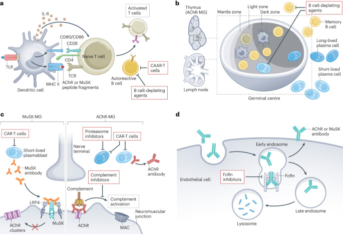 Myasthenia Gravis (MG)