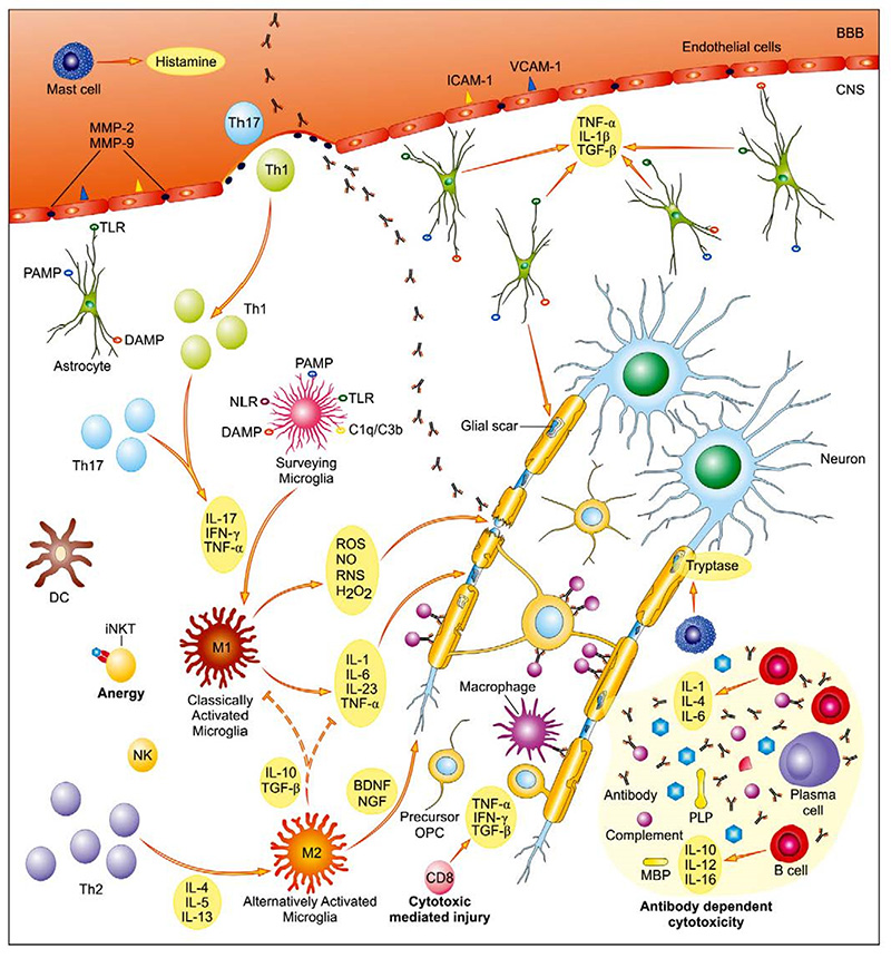 Multiple Sclerosis (MS)
