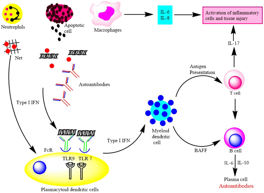 Systemic Lupus Erythematosus (SLE)
