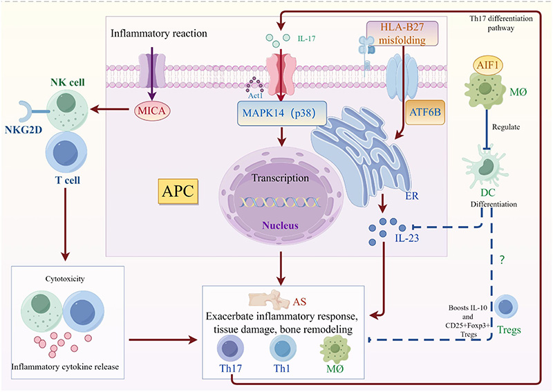 Ankylosing Spondylitis (AS)