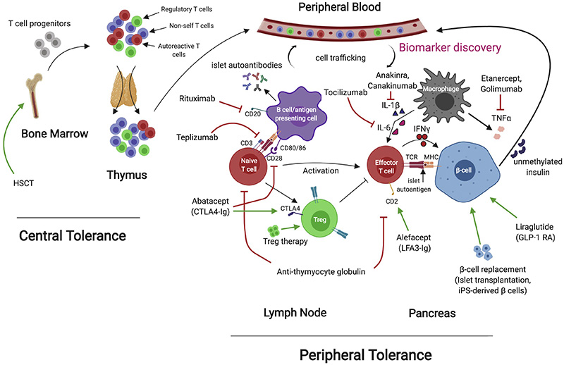 Type 1 Diabetes Mellitus (T1DM)