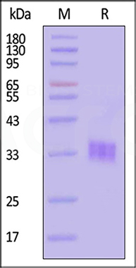 Electrophoresis (SDS-PAGE)
