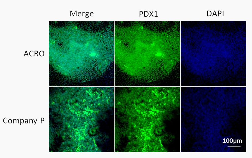 KGF promotes differentiation of pancreatic progenitor cells