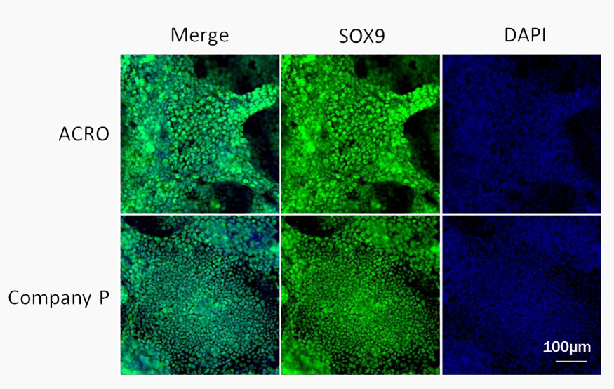 KGF promotes differentiation of pancreatic progenitor cells