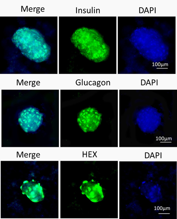 Shh and Noggin for iPSC differentiation