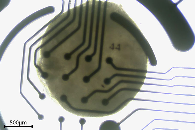 Cardiac organoids generate spontaneous spikes and bursts