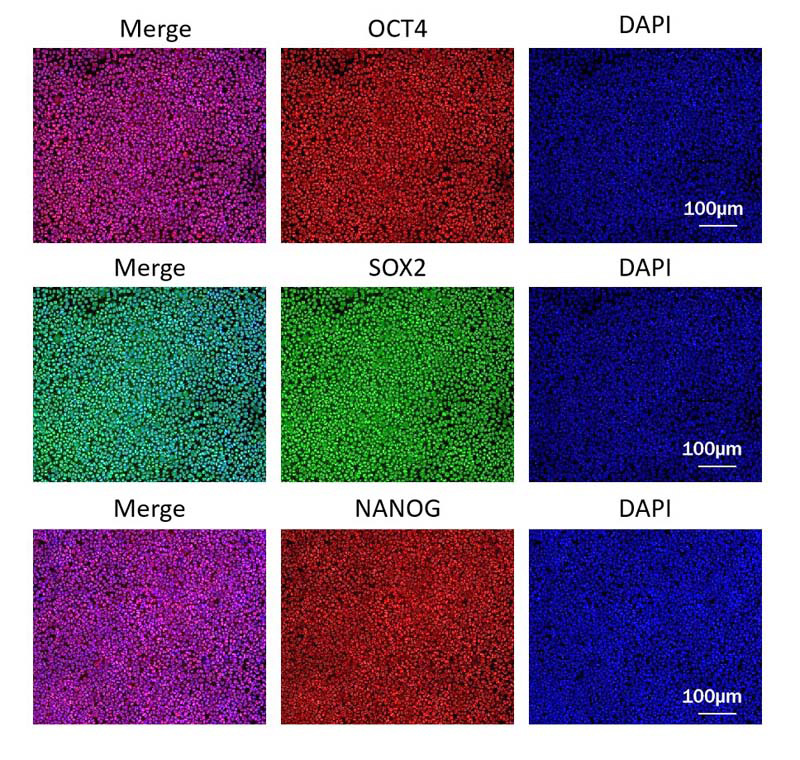 GMP-grade Laminin 511 Supports iPSC Expansion with Suspension Method