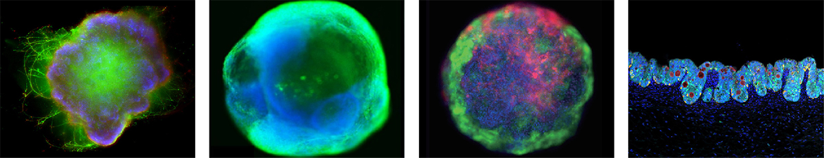 ACROBiosystems' brain, cardiac, liver, and intestinal organoids