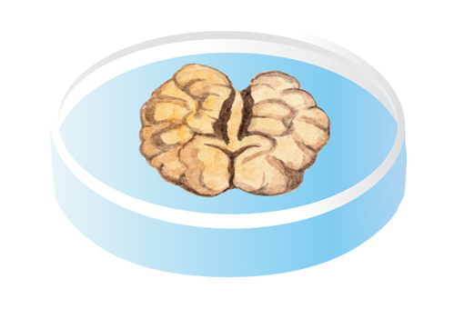 Brain Organoids
