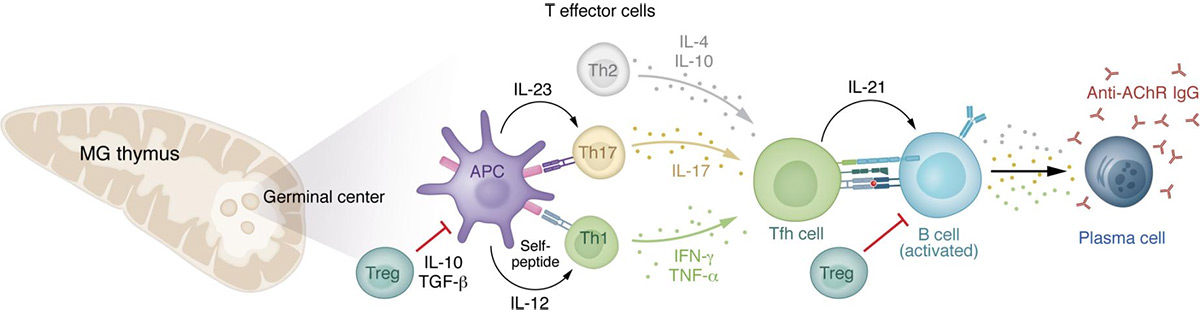 Cytokine network and immune cells in MG pathogenesis and immunoregulation