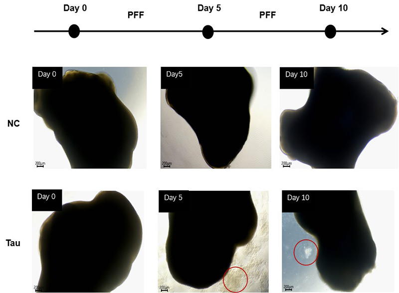 Figure 2. Cell apoptosis was observed after 5 days of Tau PFF treatment.