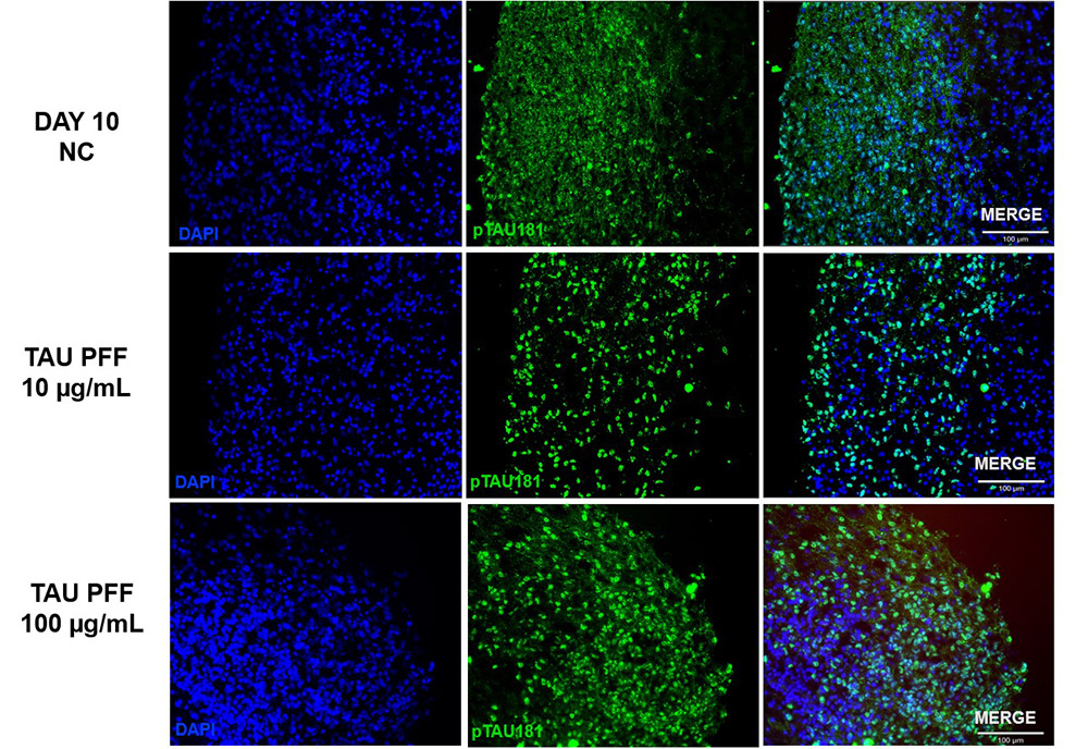 Figure 3. The expression of pTau181 increased following Tau PFF treatment.