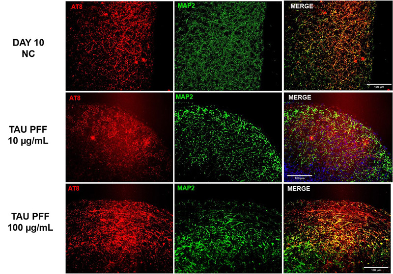 Figure 4. The expression of AT8 increased following Tau PFF treatment.