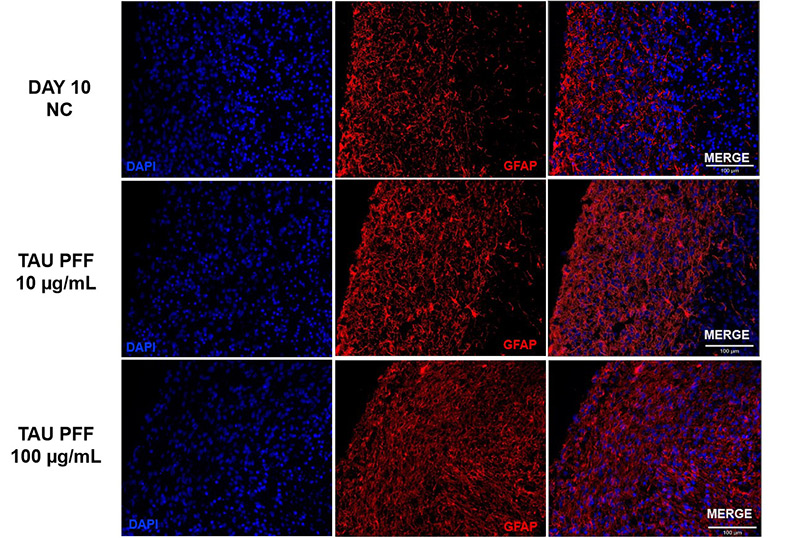Figure 6. Tau PFF treatment increased GFAP expression, leading to wider distribution and deeper penetration into the brain organoid, indicating enhanced astrocyte activation.