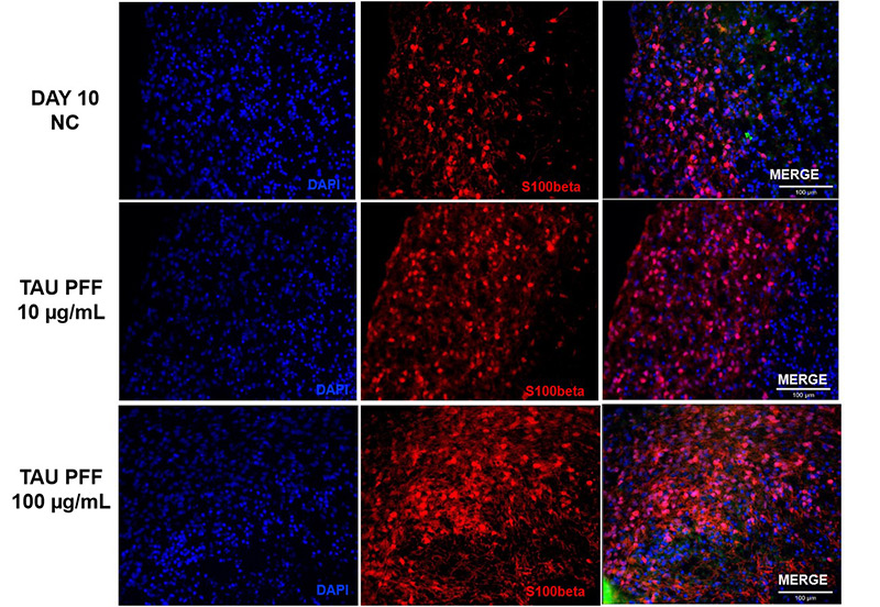 Figure 7. S100β expression also increased after Tau PFF treatment, likely due to astrocyte activation and potential involvement in neuroinflammatory responses.