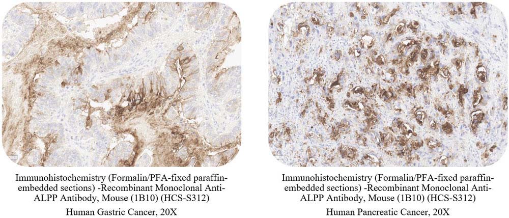 ALPP SAMPLE STAINING DATA