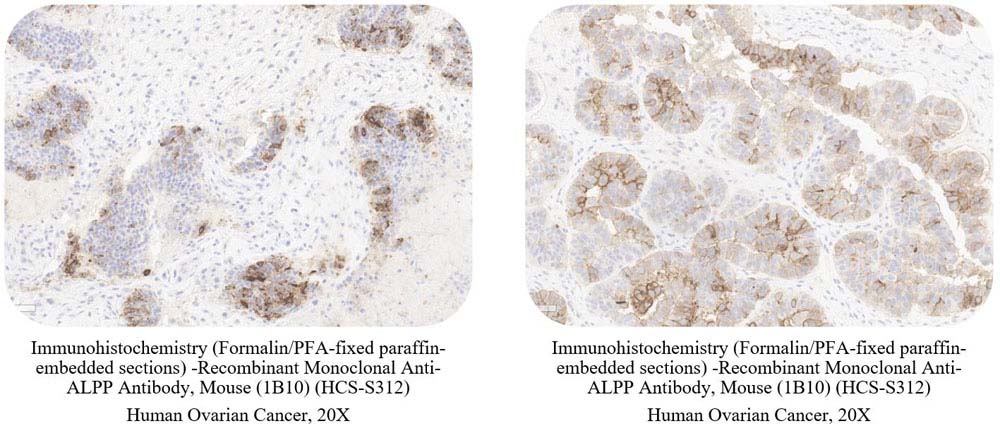 ALPP SAMPLE STAINING DATA