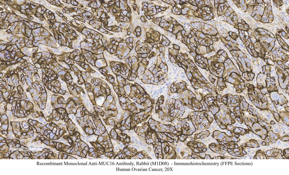 MUC16 SAMPLE STAINING DATA