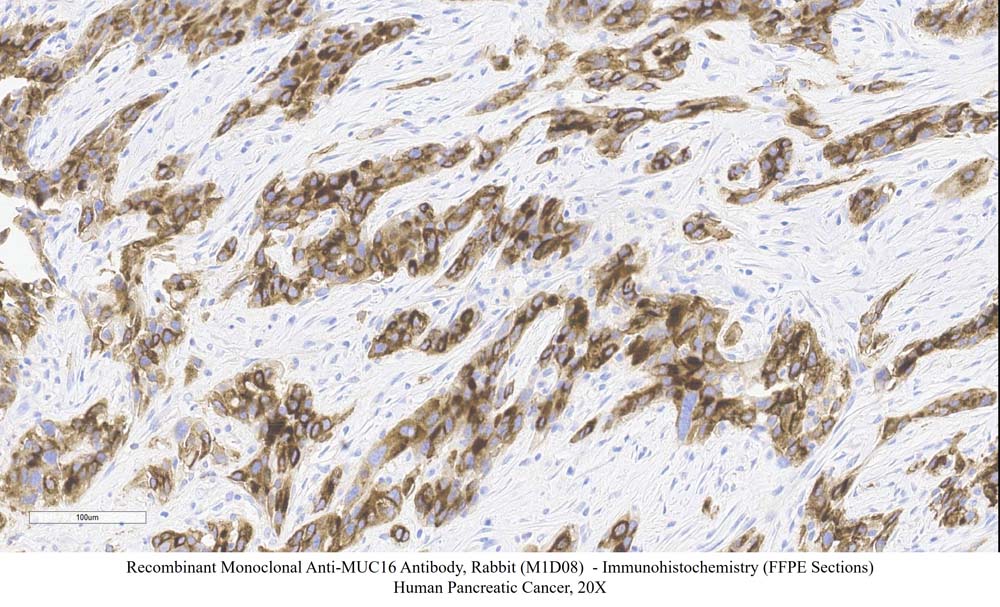 MUC16 SAMPLE STAINING DATA