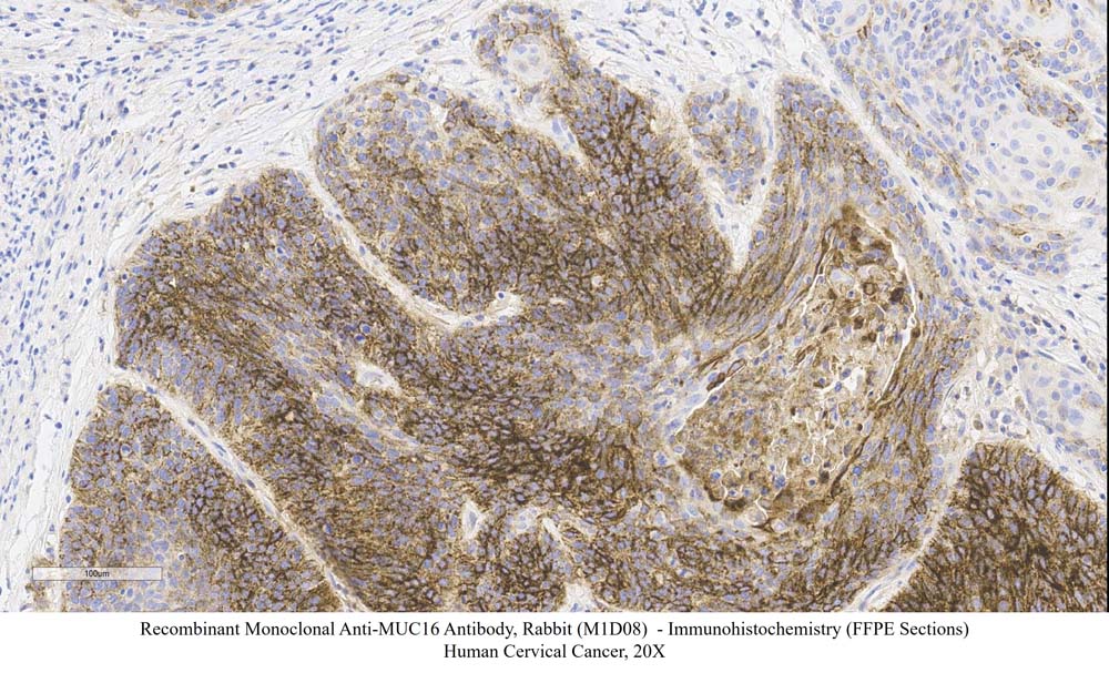 MUC16 SAMPLE STAINING DATA