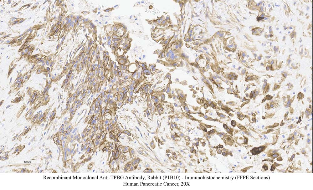 TPBG SAMPLE STAINING DATA