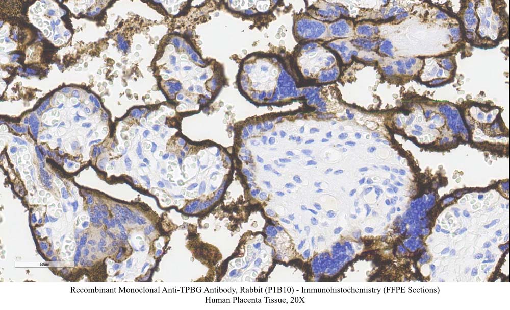 TPBG SAMPLE STAINING DATA