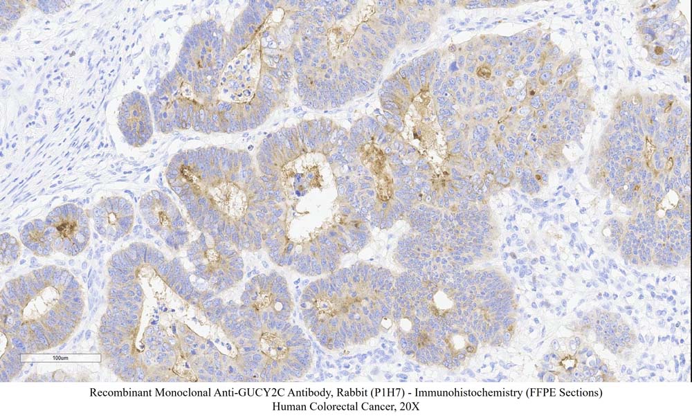GUCY2C SAMPLE STAINING DATA