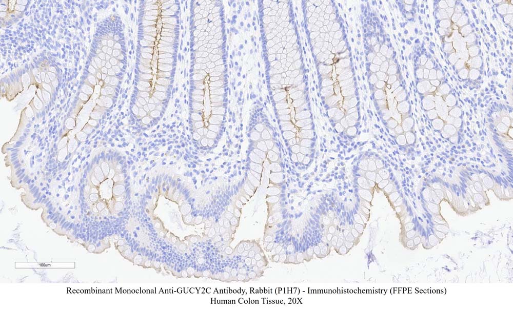 GUCY2C SAMPLE STAINING DATA