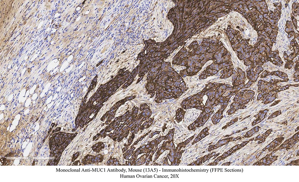 Mucin-1 SAMPLE STAINING DATA