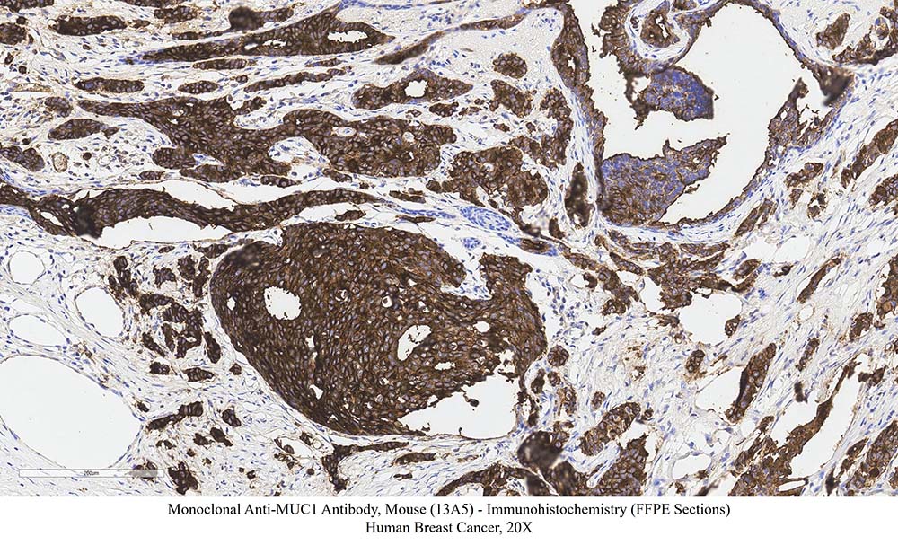Mucin-1 SAMPLE STAINING DATA