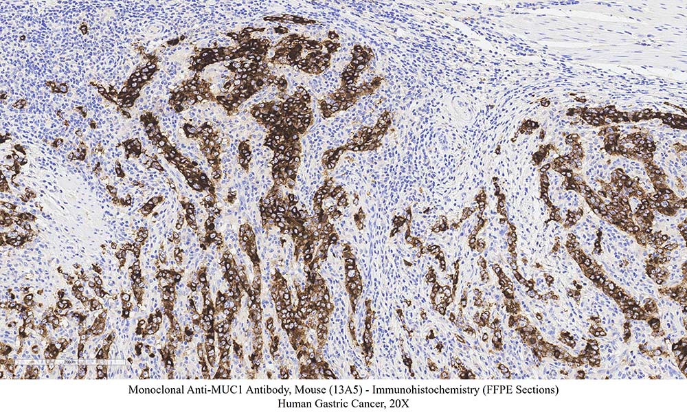 Mucin-1 SAMPLE STAINING DATA
