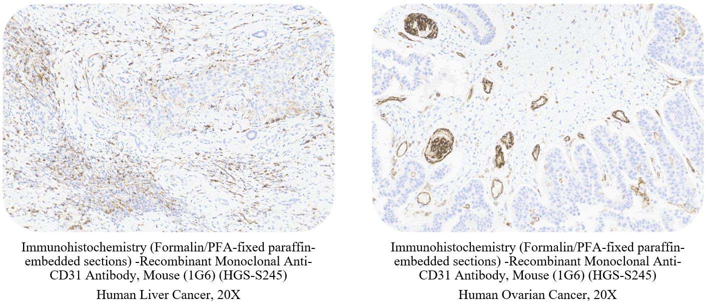 CD31 SAMPLE STAINING DATA