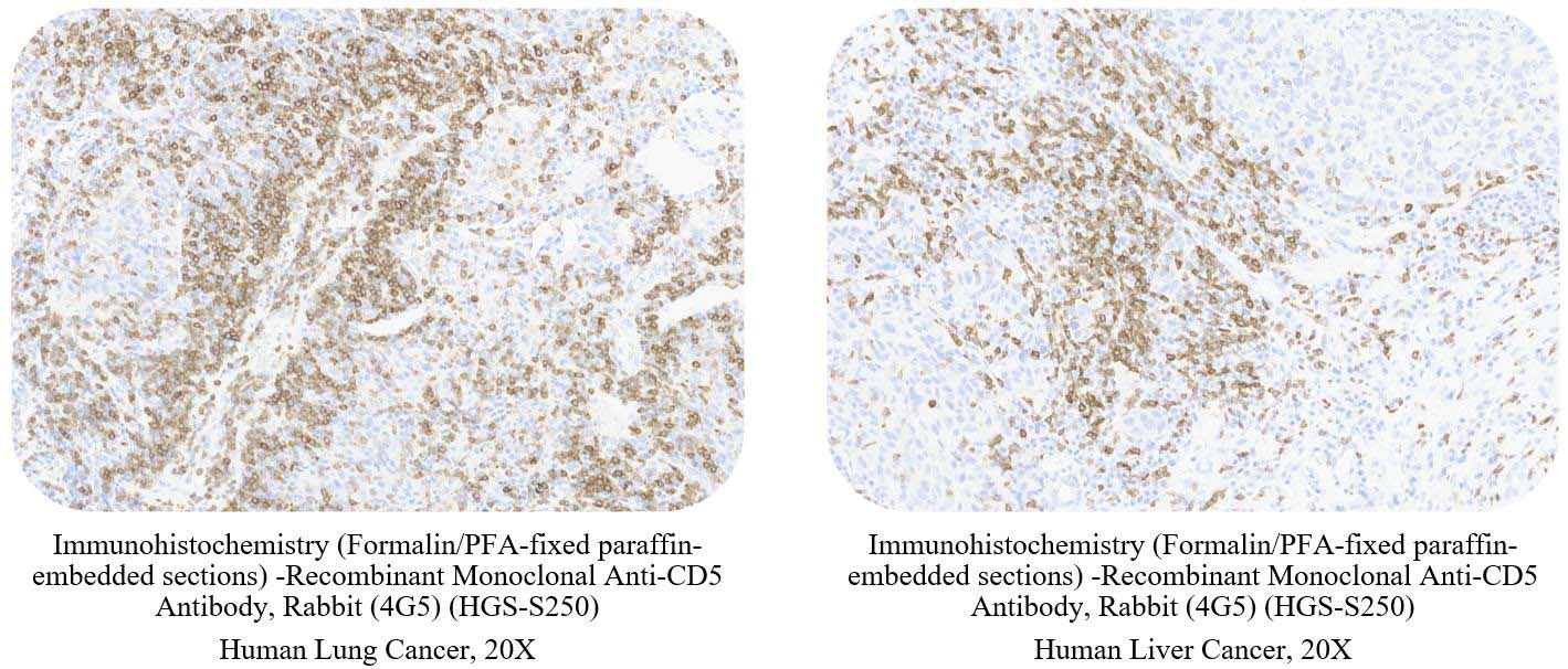 CD5 SAMPLE STAINING DATA