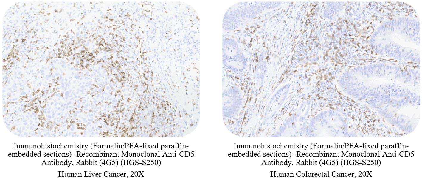 CD5 SAMPLE STAINING DATA