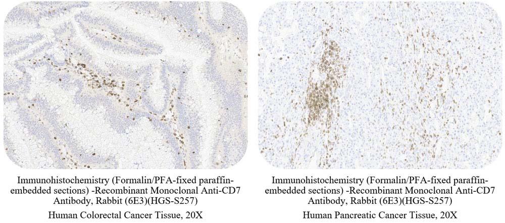 CD7 SAMPLE STAINING DATA