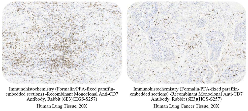 CD7 SAMPLE STAINING DATA