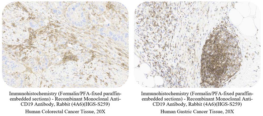 CD19 SAMPLE STAINING DATA