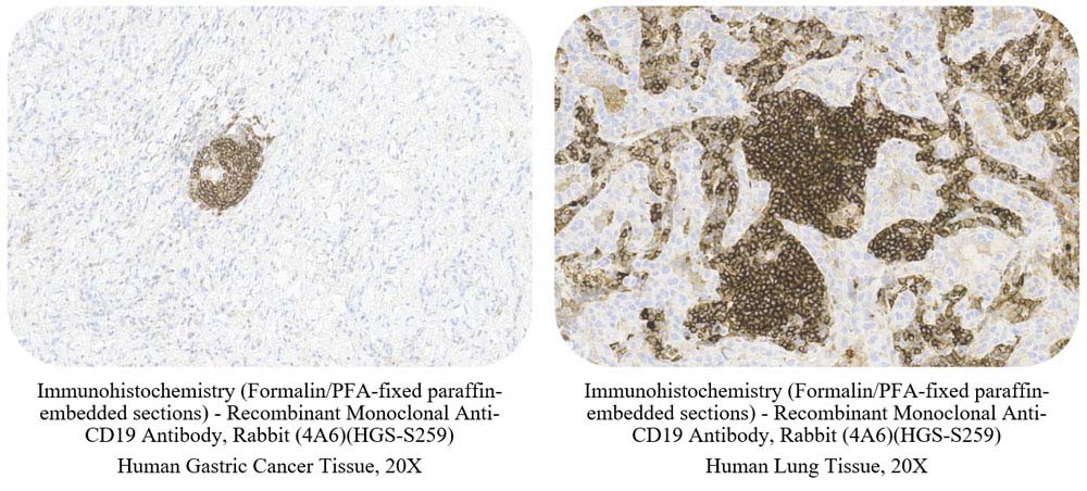 CD19 SAMPLE STAINING DATA