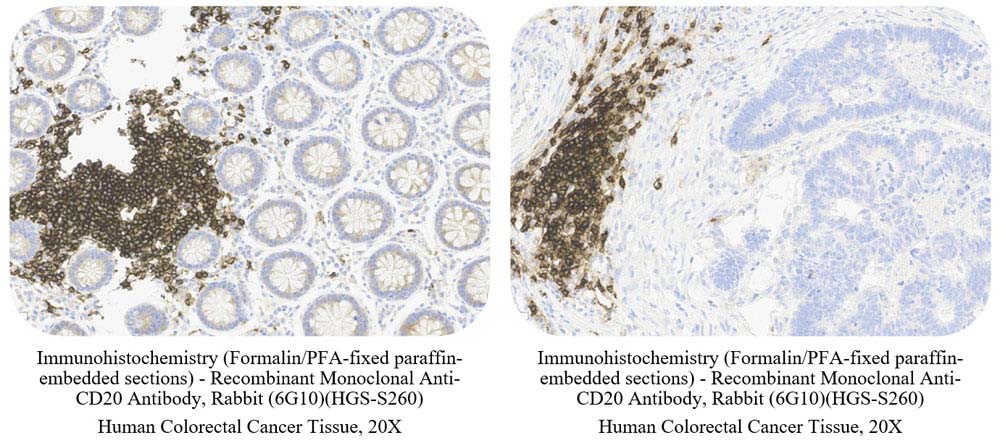 CD20 SAMPLE STAINING DATA