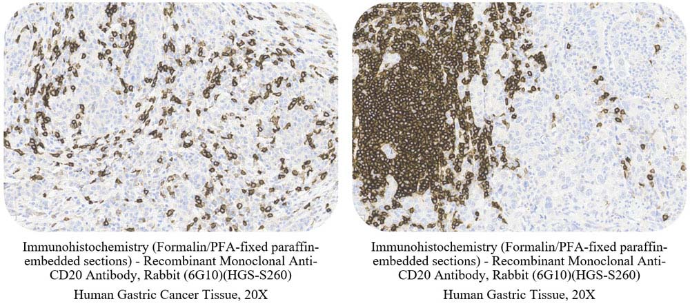 CD20 SAMPLE STAINING DATA