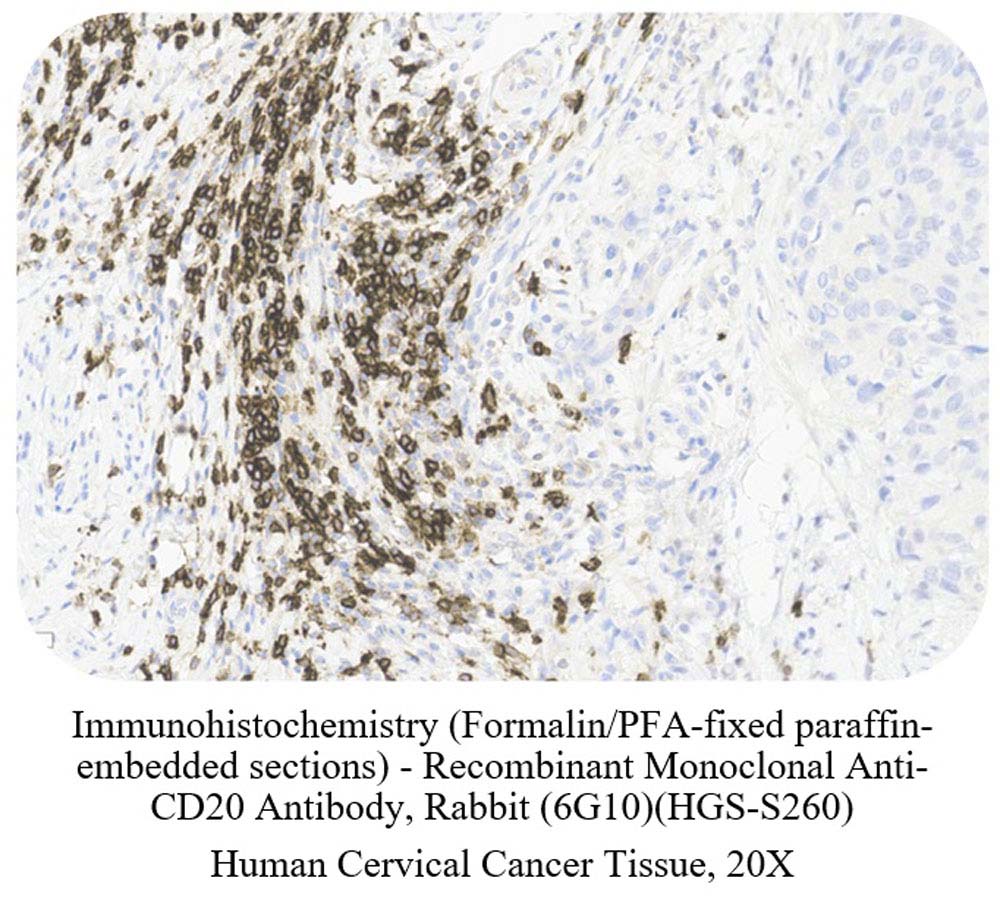 CD20 SAMPLE STAINING DATA