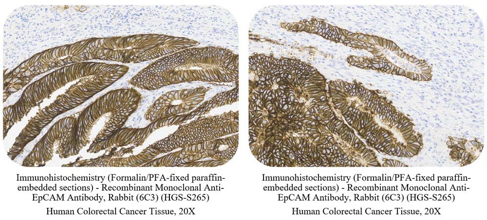 EpCAM SAMPLE STAINING DATA