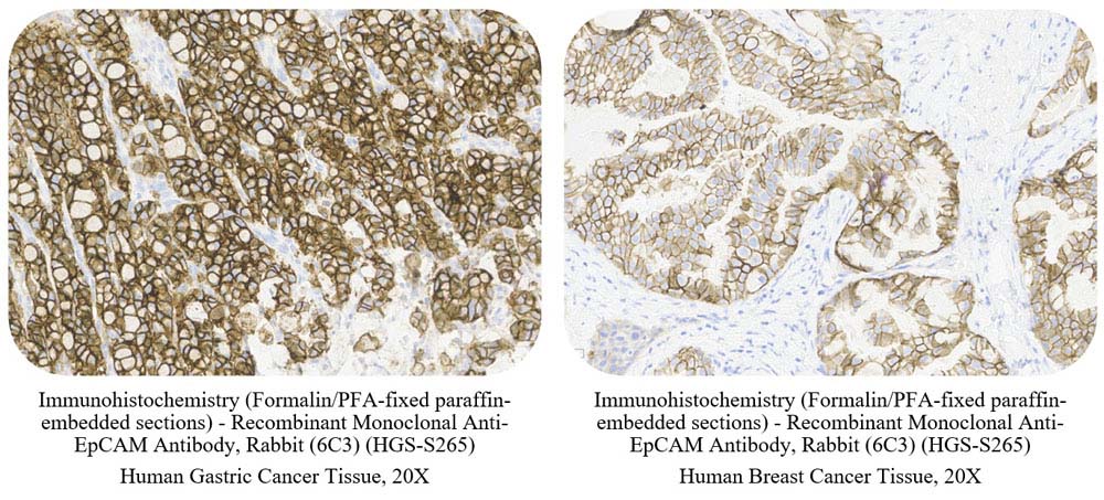 EpCAM SAMPLE STAINING DATA