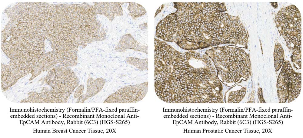 EpCAM SAMPLE STAINING DATA
