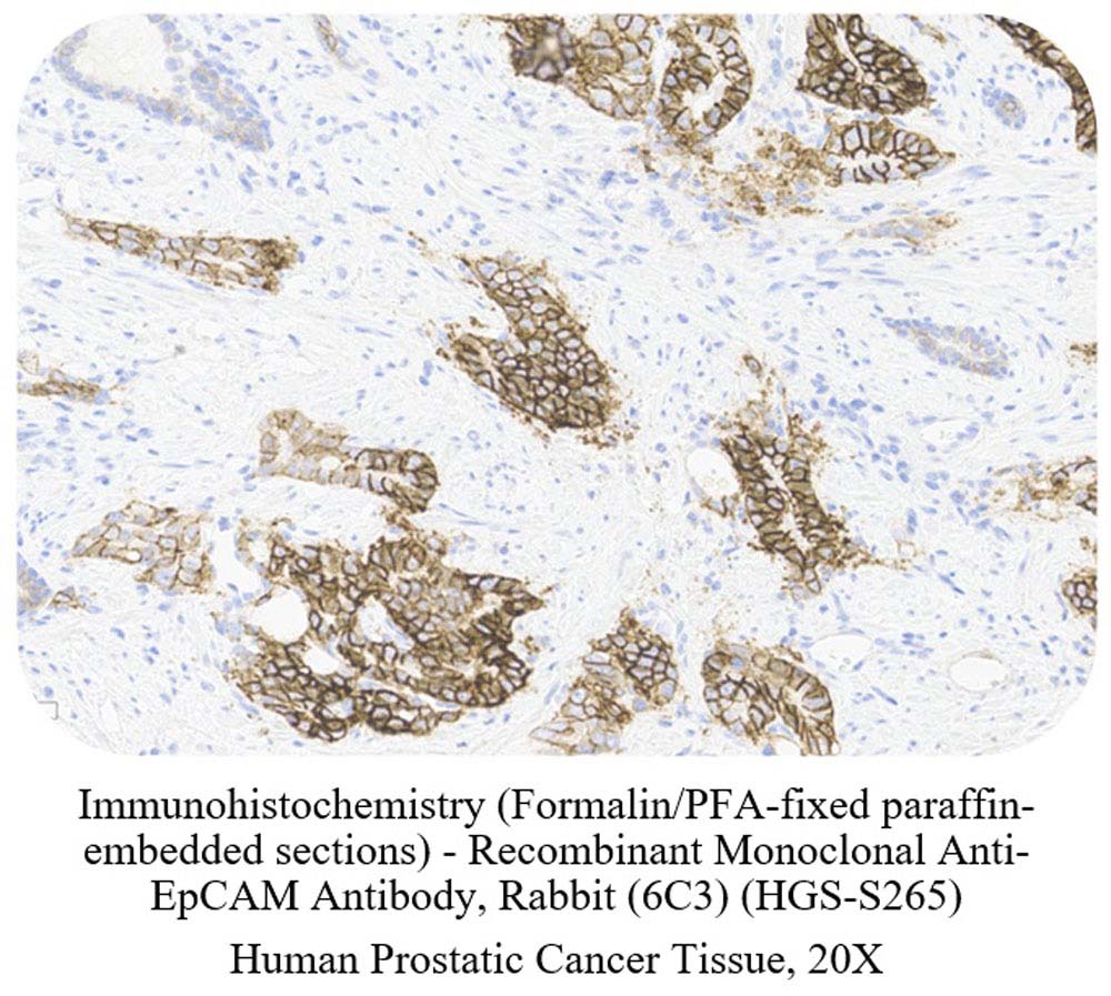 EpCAM SAMPLE STAINING DATA
