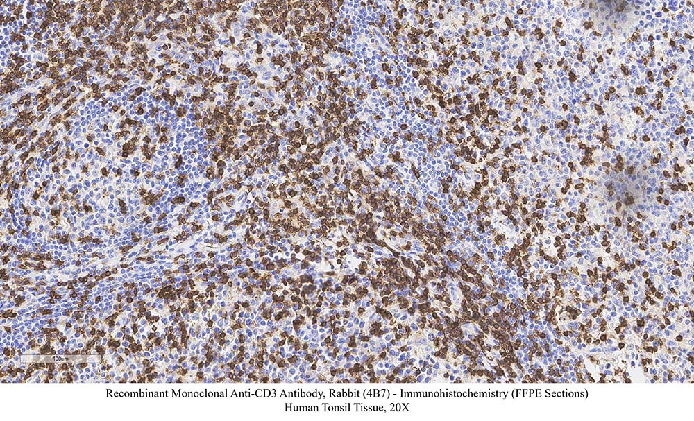 CD3 SAMPLE STAINING DATA