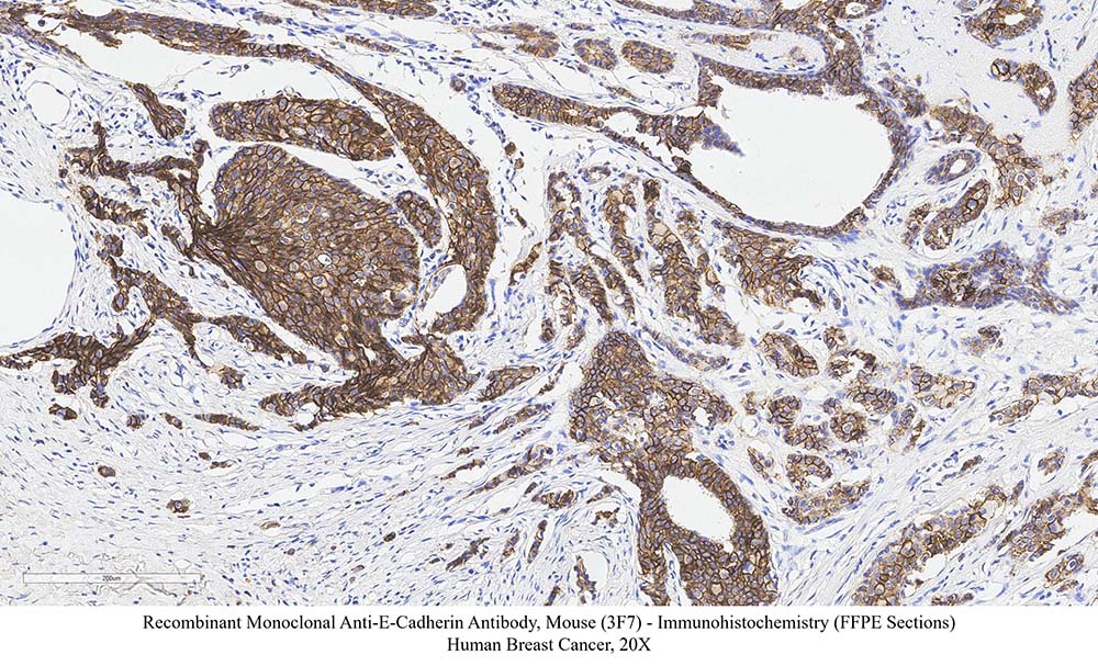 E-Cadherin SAMPLE STAINING DATA