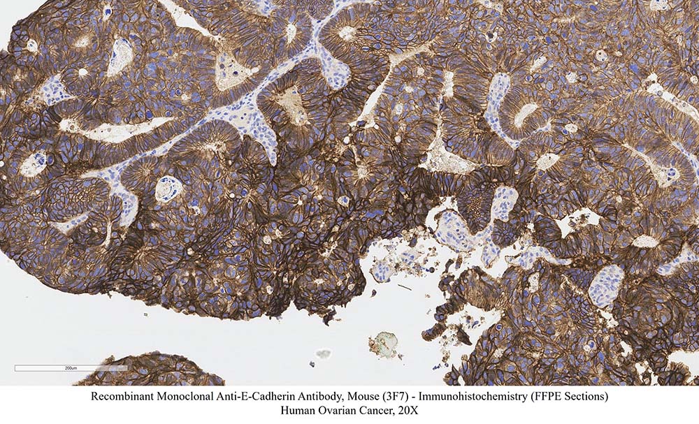 E-Cadherin SAMPLE STAINING DATA