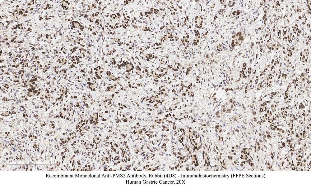 PMS2 SAMPLE STAINING DATA