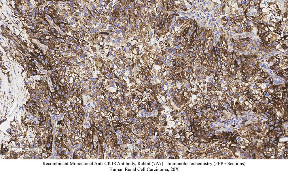 CK18 SAMPLE STAINING DATA